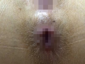 素人娘のアナル図鑑 呼吸をするようにヒクヒクと動く肛門をじっくり観察 おっぴろげアナルコレクション12人　サンプル画像09